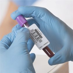 CCHLPP050 test tube label (8)